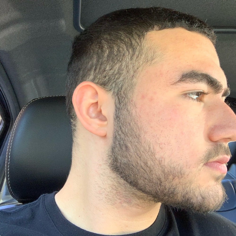 Meet your Posher, Anthony